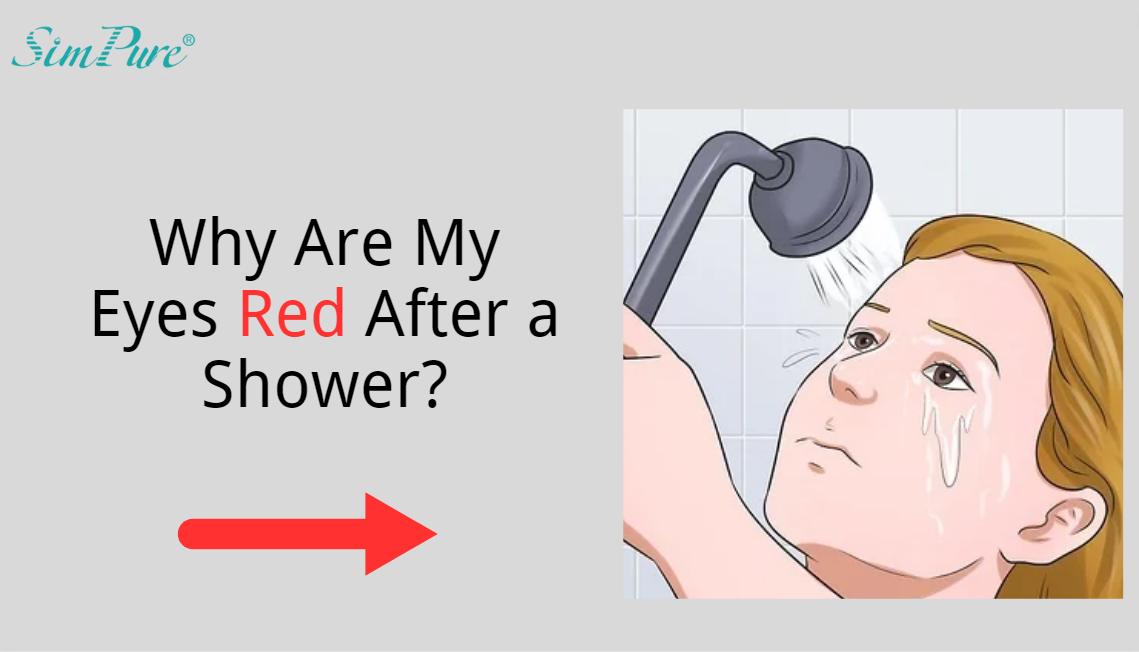 why are my eyes red after a shower