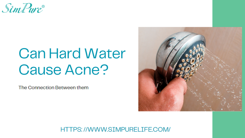 can hard water cause acne