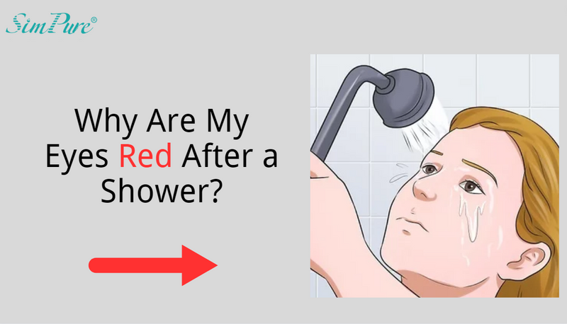 why are my eyes red after a shower