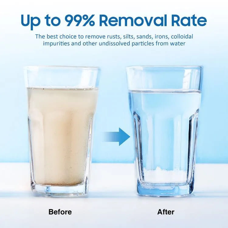 Membrane Solutions 10" x 2.5" Whole House PP Sediment Water Filter Replacement Cartridge 1/5/10/20/25/50 Micron